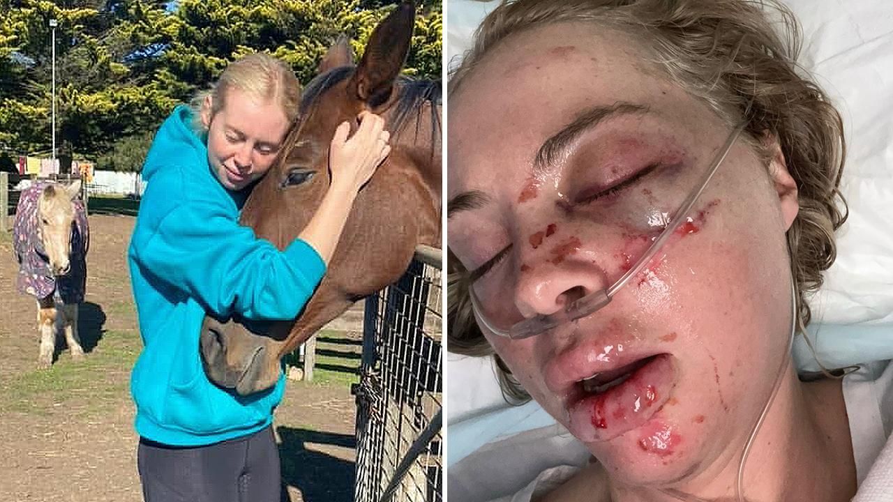 Appeal launched to help injured track rider Alannah Logie